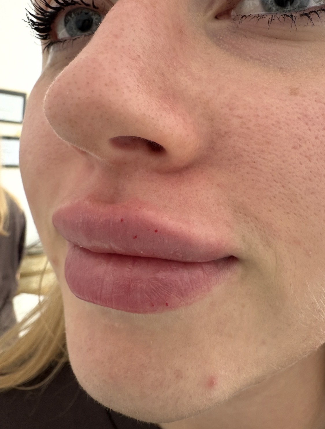 Lip Flip